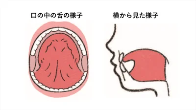 「タングバキューム」