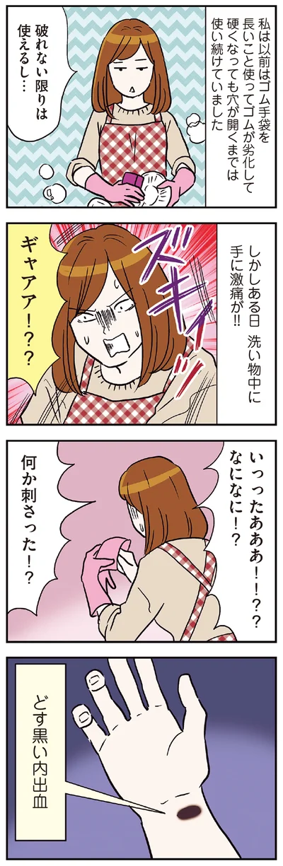 ある日洗い物中に手に激痛が！！
