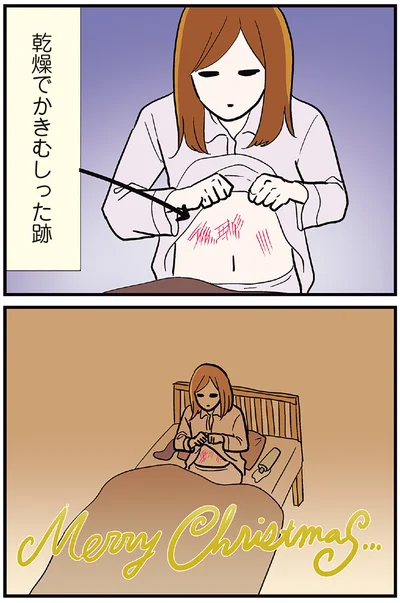 乾燥でかきむしった跡も…