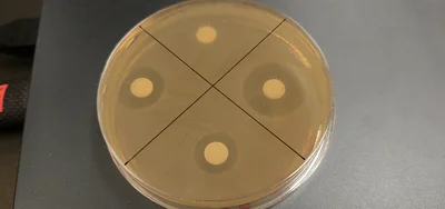 この抗生物質は、偶然に、それも失敗した実験を契機に発見された。