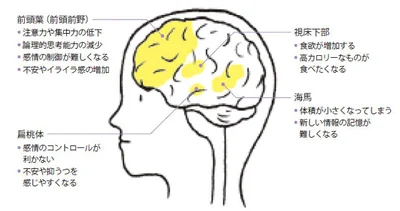 睡眠不足は脳のパフォーマンスに直結