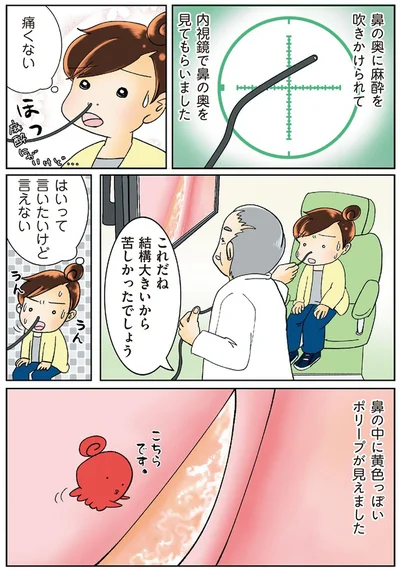 『鼻腔ガンになった話』より