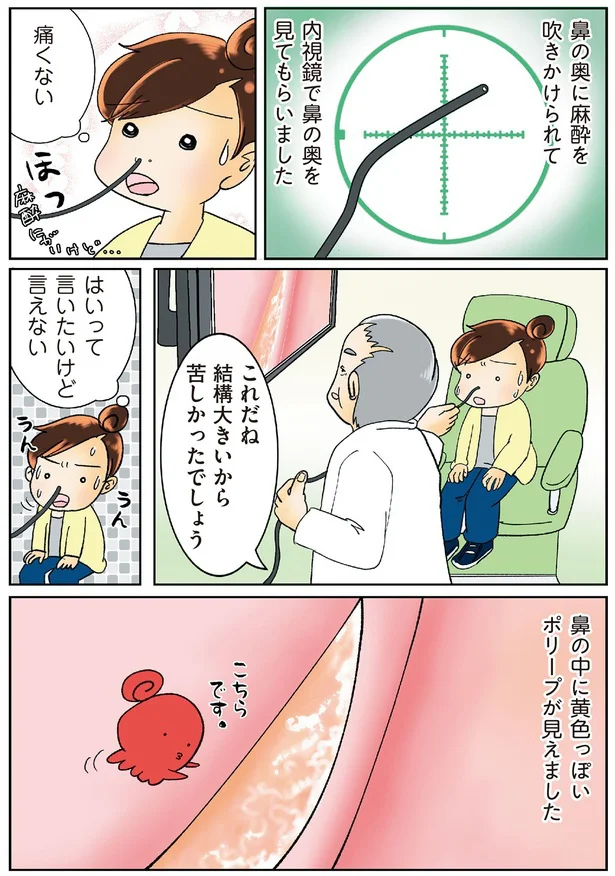 『鼻腔ガンになった話』より