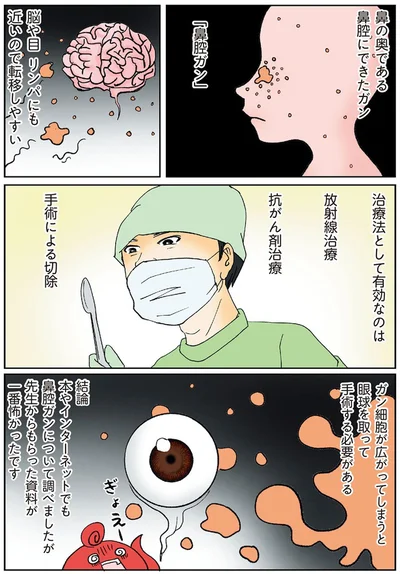 『鼻腔ガンになった話』より