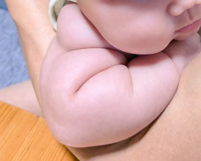 赤ちゃんならではのムチムチ!▶「確かに!」とうなづけるママのコメント(⇒次へ)