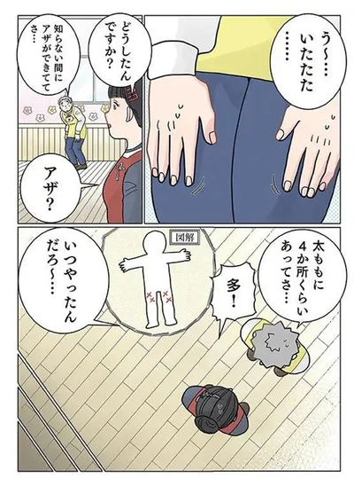 知らないアザ