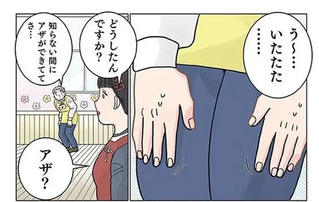 知らない間に保育士の太ももにアザが！ 翌日判明した「原因」は？