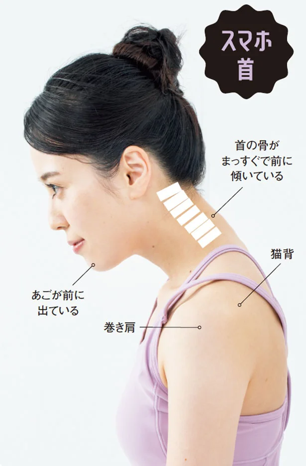 スマホ首