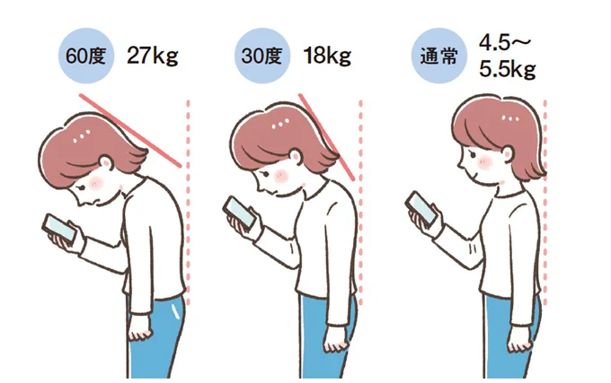 正しい姿勢では首にかかる頭の重さは5㎏前後。下を向くほど首への負担が大きくなり、60度下へ傾くと通常の5~6倍の負担が首に!!