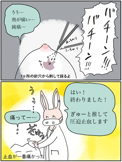止血が一番痛かった