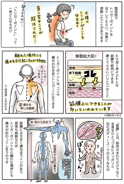 「トリガーポイント」って一体どんなもの！？