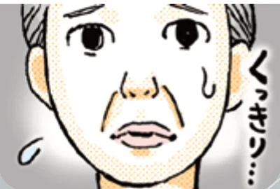 ほうれい線