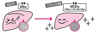 7％の体重減で脂肪肝が改善