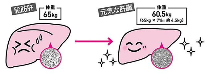7%の体重減で脂肪肝が改善