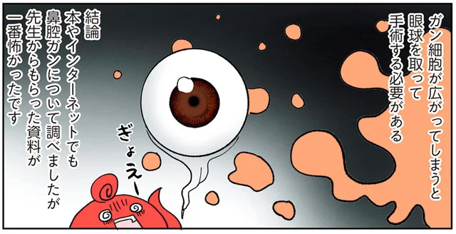眼球を摘出するおそれも!? 3度目の転院でわかった鼻腔ガンとは？／鼻腔ガンになった話（7）