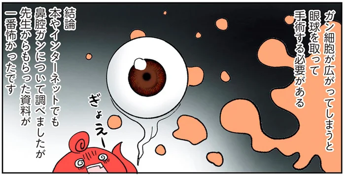 眼球を摘出するおそれも!? 3度目の転院でわかった鼻腔ガンとは？／鼻腔ガンになった話（7）