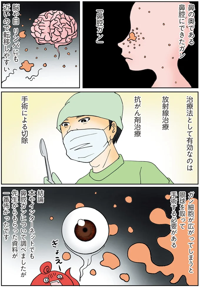 脳や目リンパにも近いので転移しやすい