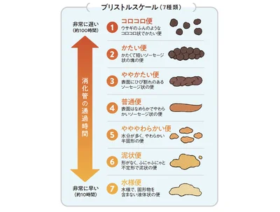 ブリストルスケール：「4」である表面がなめらかなソーセージ状の便が2日に1回出れば腸活成功。臭くなく、水に浮く便であれば、ベストの腸内環境