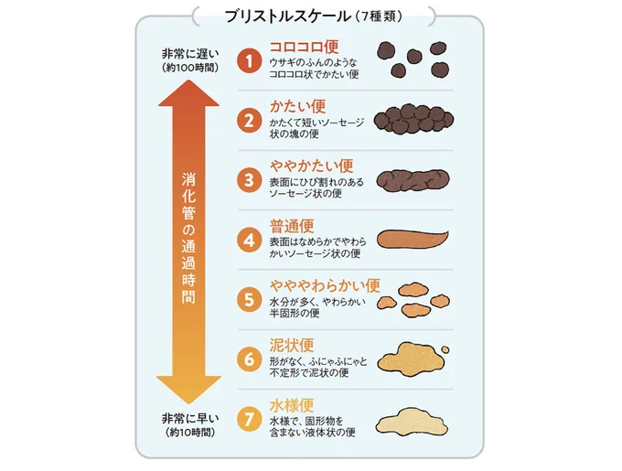 ブリストルスケール:「4」である表面がなめらかなソーセージ状の便が2日に1回出れば腸活成功。臭くなく、水に浮く便であれば、ベストの腸内環境