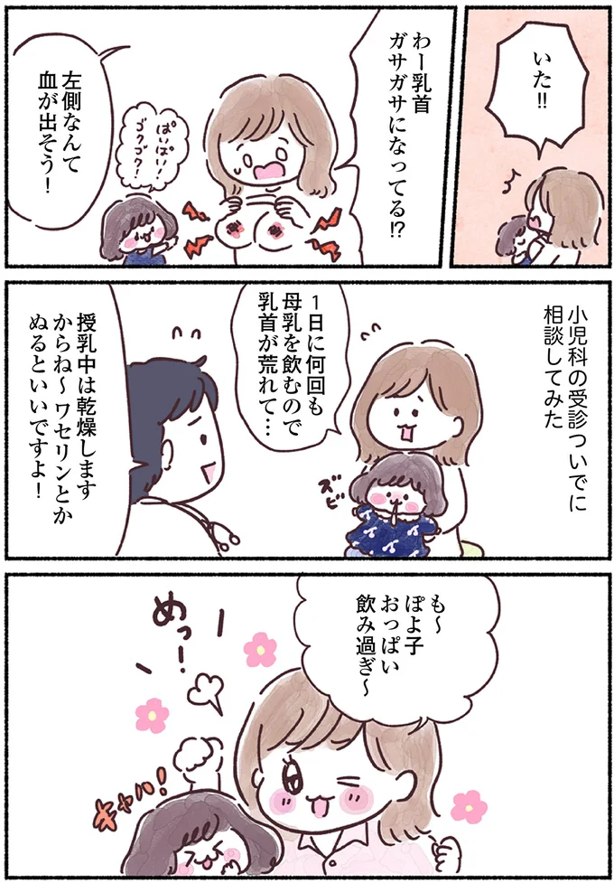 乳房ガサガサになってる!?