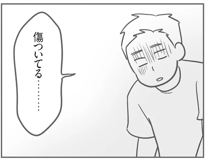 傷ついてる…