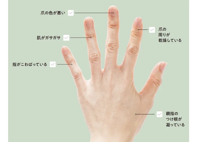 手から分かるお疲れ度チェック