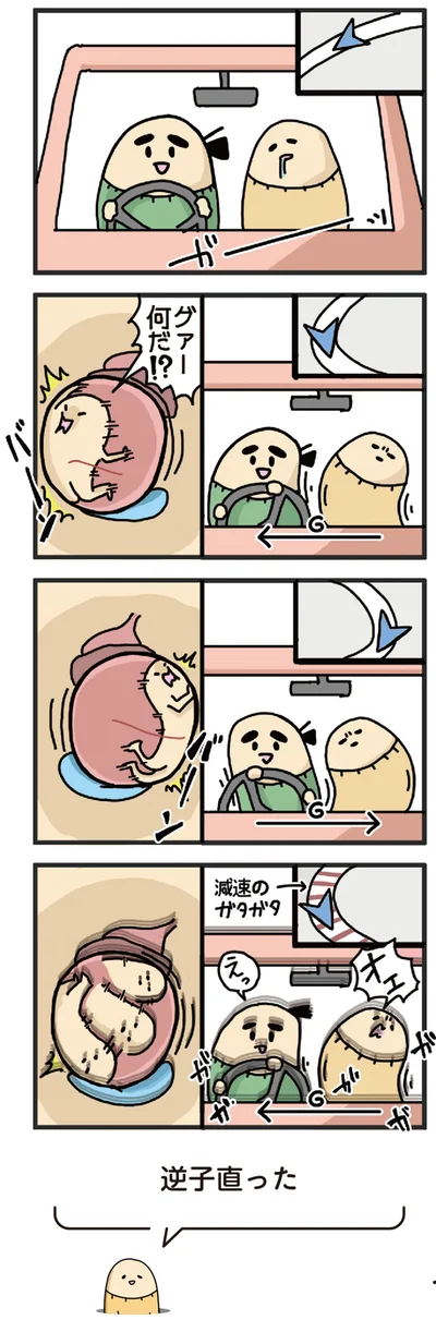逆子直った
