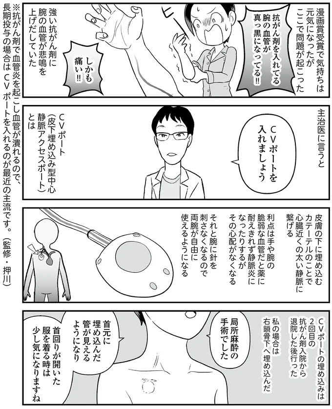 CVポートを入れましょう