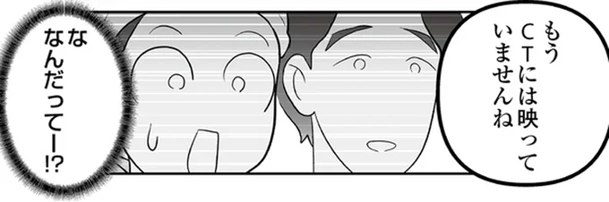 もうCTには映っていませんね