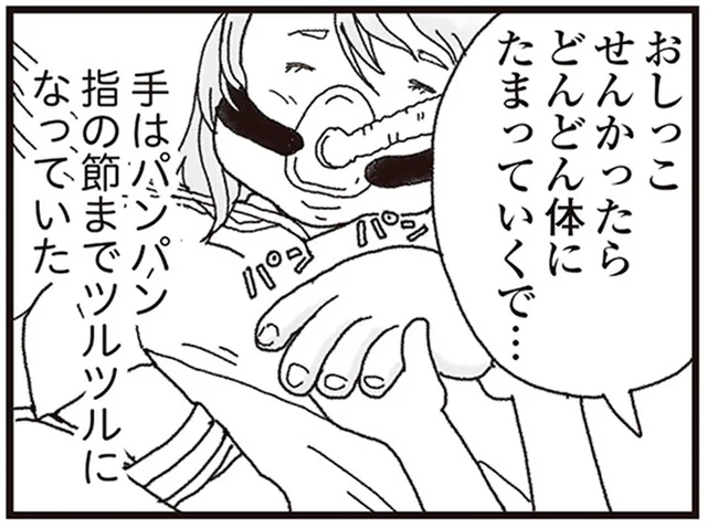 妻の闘病が始まり2週間。排尿がなく、全身が水分でパンパンに／私がシングルファザーになった日（13）