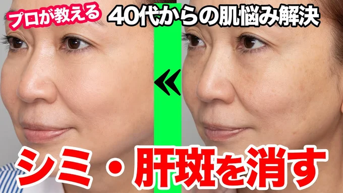 SHOKOさんのビフォーアフター
