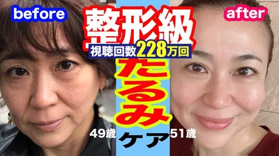 SHOKOさんのビフォーアフター