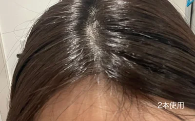 ロクシタン メディカル アンチヘアロスセラム2本使用後