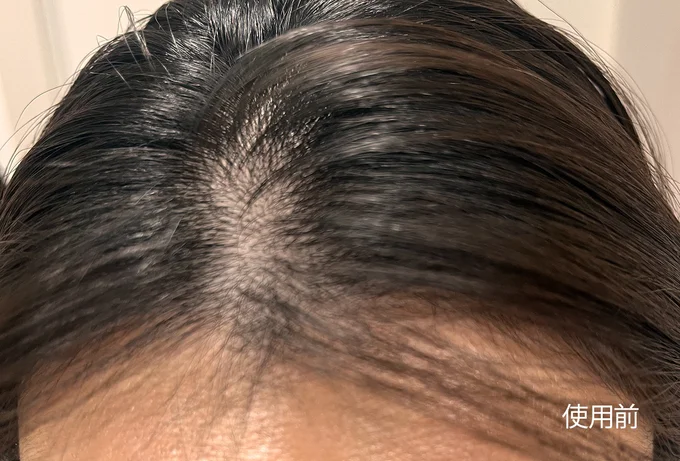 ロクシタン メディカル アンチヘアロスセラム使用前