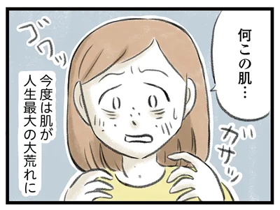 肌が大荒れに