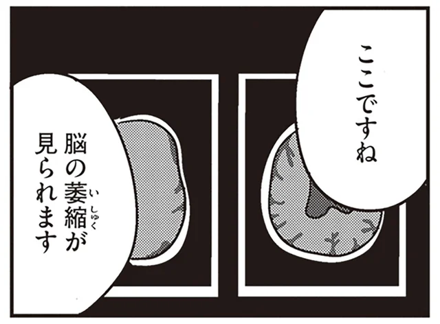 「脳の萎縮が見られます」若年性認知症と診断された夫の隣で妻は呆然／夫がわたしを忘れる日まで（7）