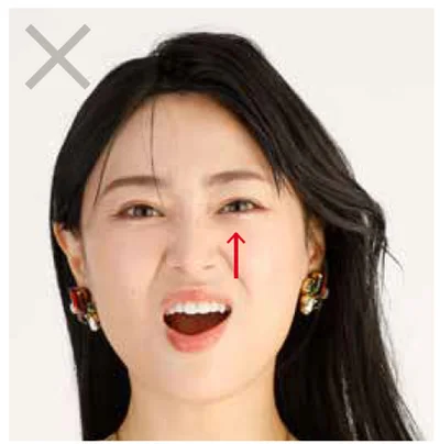 小鼻の上からほうれい線