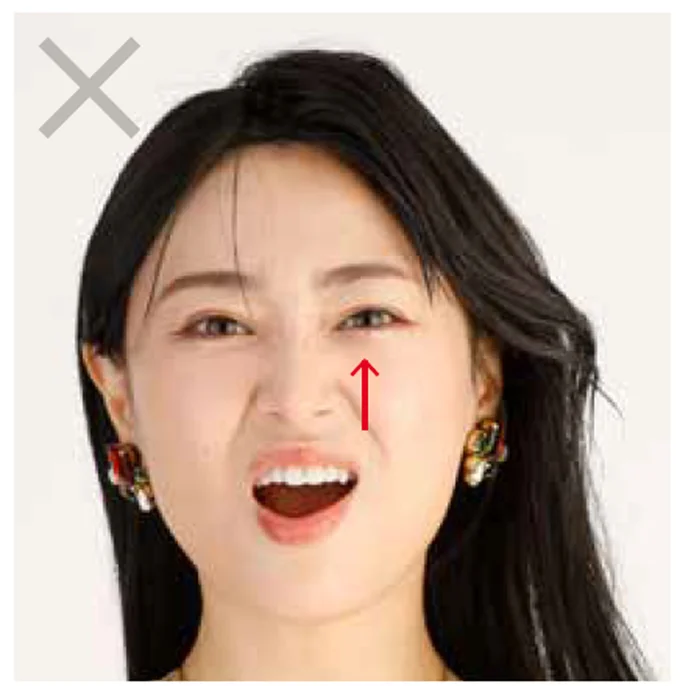 小鼻の上からほうれい線
