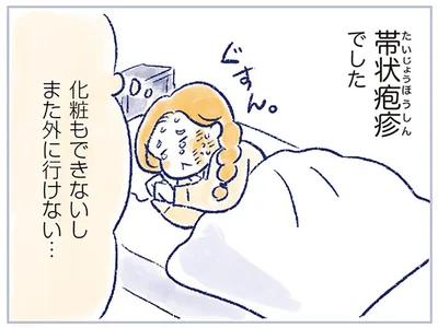 帯状疱疹でした