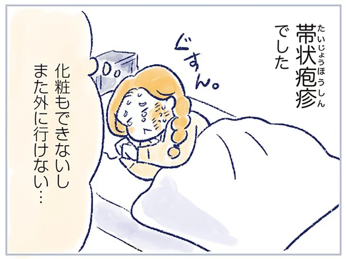 帯状疱疹でした
