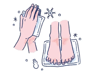保冷剤で手のひらと足の裏を冷やす