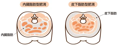 2種類の体脂肪のつき方は？