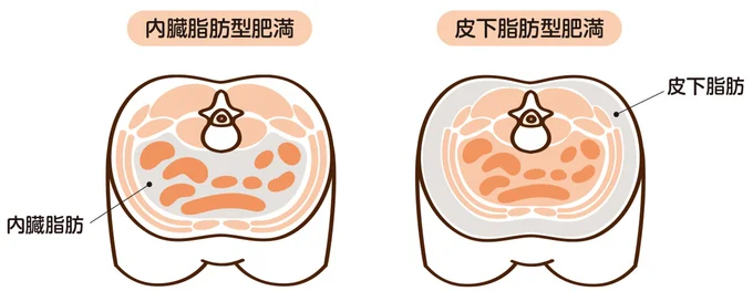 2種類の体脂肪のつき方は？