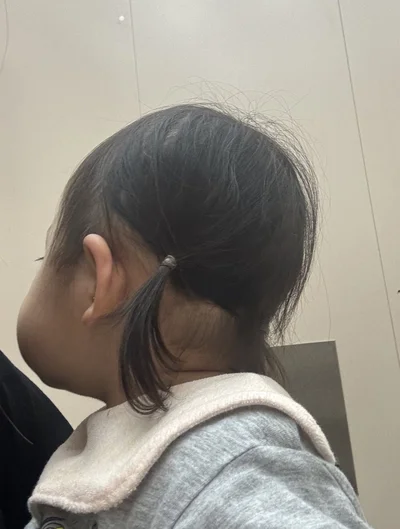 「娘のこの角度のほっぺ、すごすぎる」と投稿された写真です▶覚えたてのピース写真（⇒次へ）