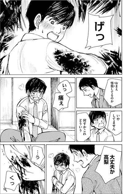 おまえ怪我してるのか