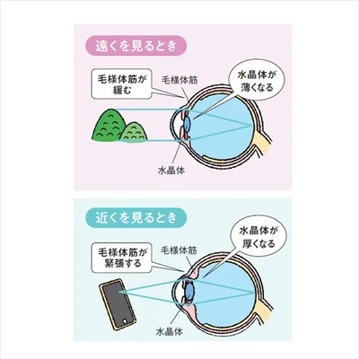 普通の老眼と何が違う？