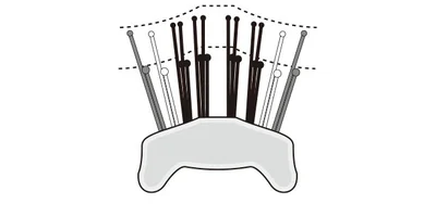 密着設計で頭皮にぴったりフィット