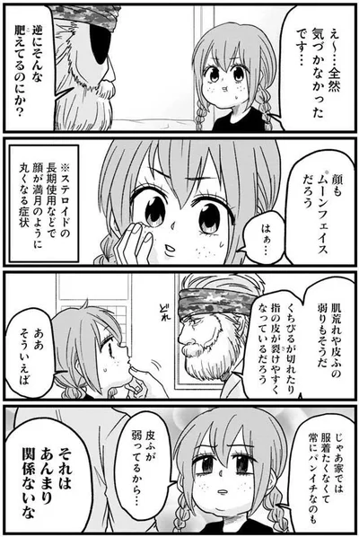 顔もムーンフェイスだろう