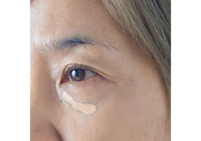 黒ずんだ部分全体にベッタリは、もちろんNG