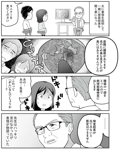 直腸に腫瘍があります